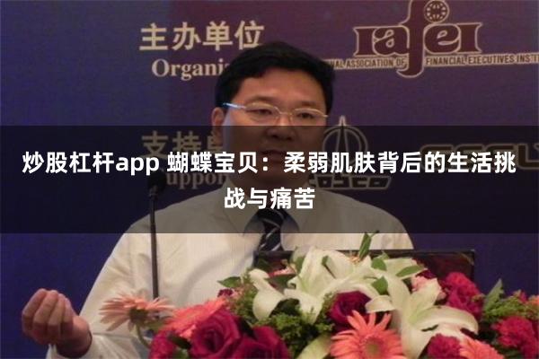 炒股杠杆app 蝴蝶宝贝：柔弱肌肤背后的生活挑战与痛苦